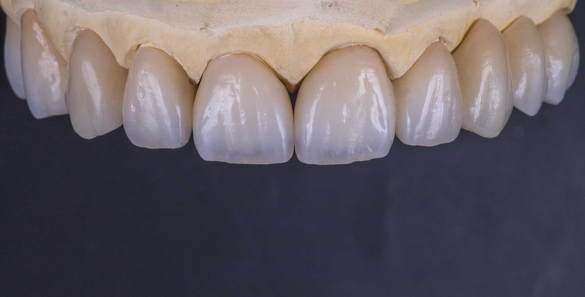 Programa de formación de Especialista en Rehabilitación Oral