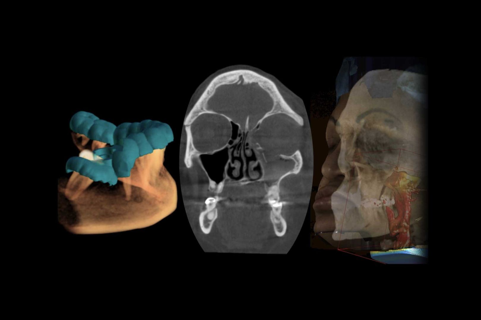 Programa de formación de Especialista en Imagenología Oral y Maxilofacial