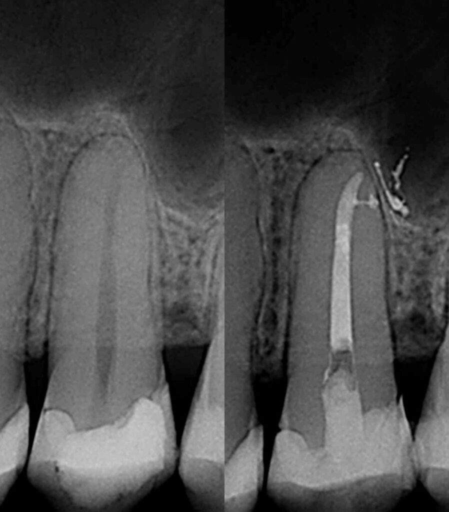 Programa de formación de Especialista en Endodoncia
